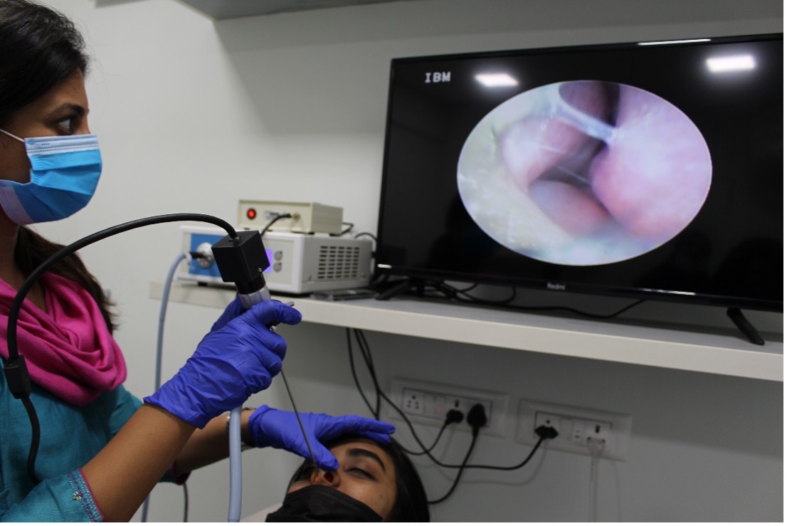 ENT specialist performing a nasal endoscopy at Excell ENT Clinic Bangalore