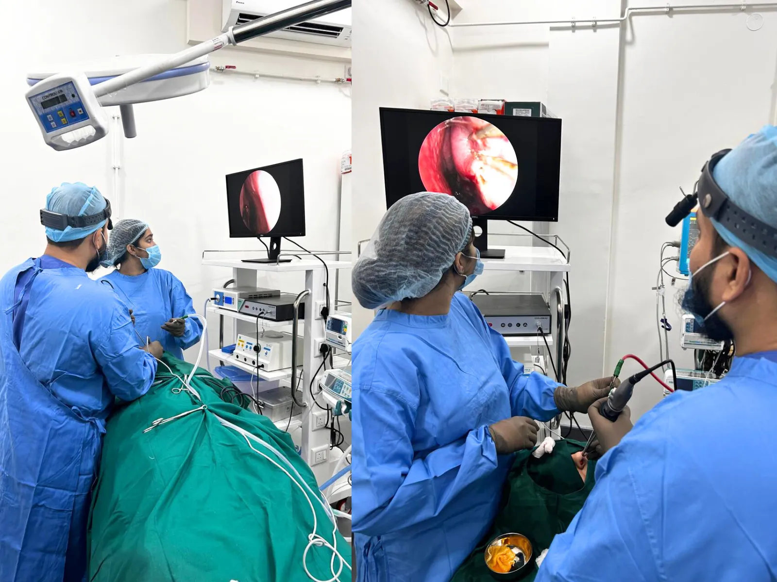 Excell ENT Clinic surgical team at work, Frazer Town, Bengaluru